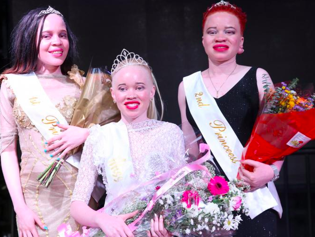 au-zimbabwe-concours-miss-albinos-contre-les-prejuges-violence_width1024